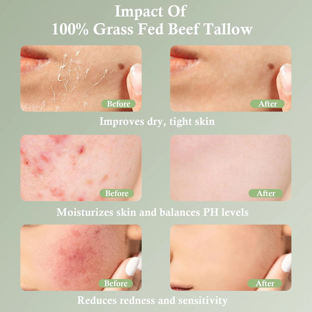 Grass-Fed Tallow Moisturizing Cream – Soothing & Nourishing Skincare