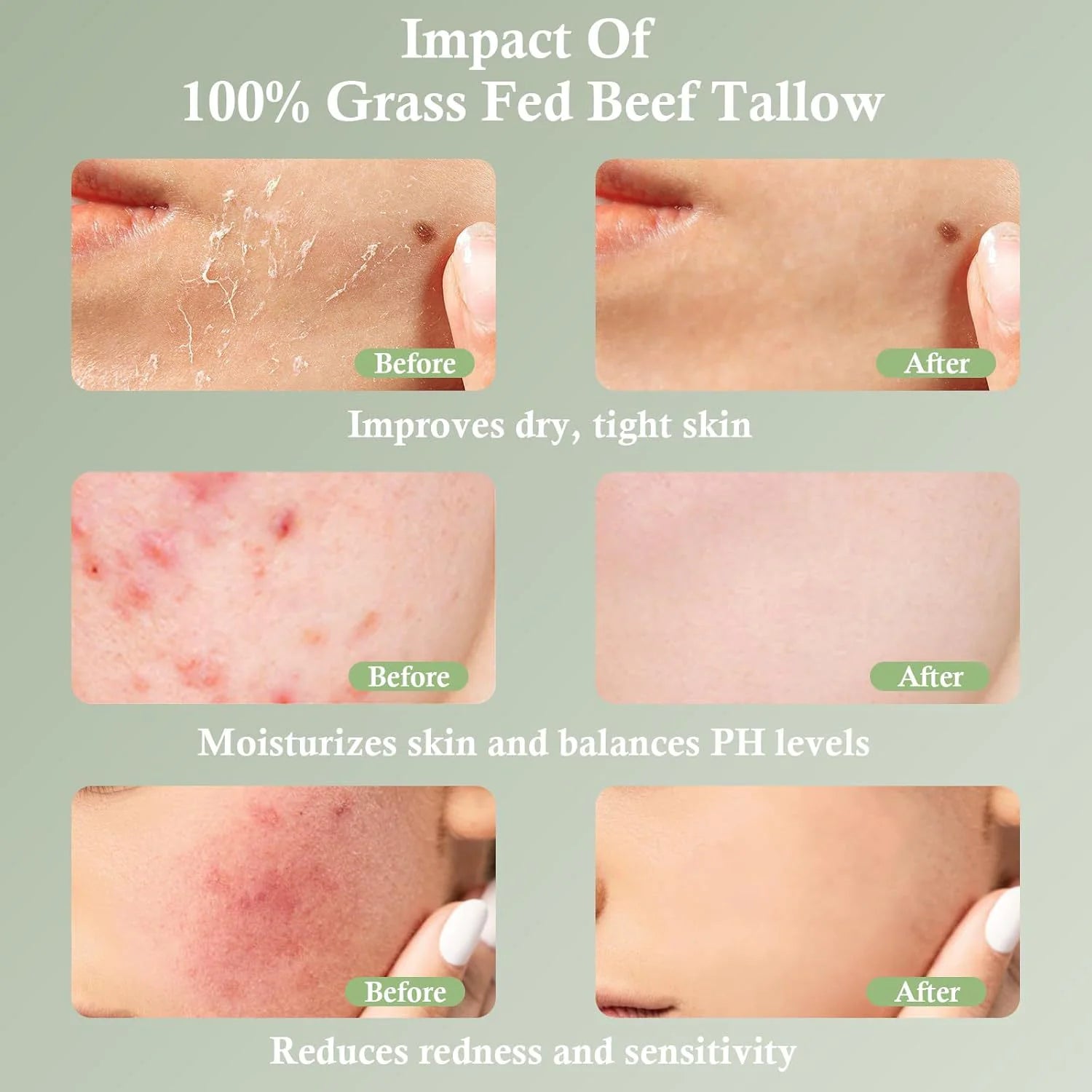 Grass-Fed Tallow Moisturizing Cream – Soothing & Nourishing Skincare